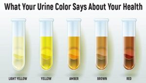 urine