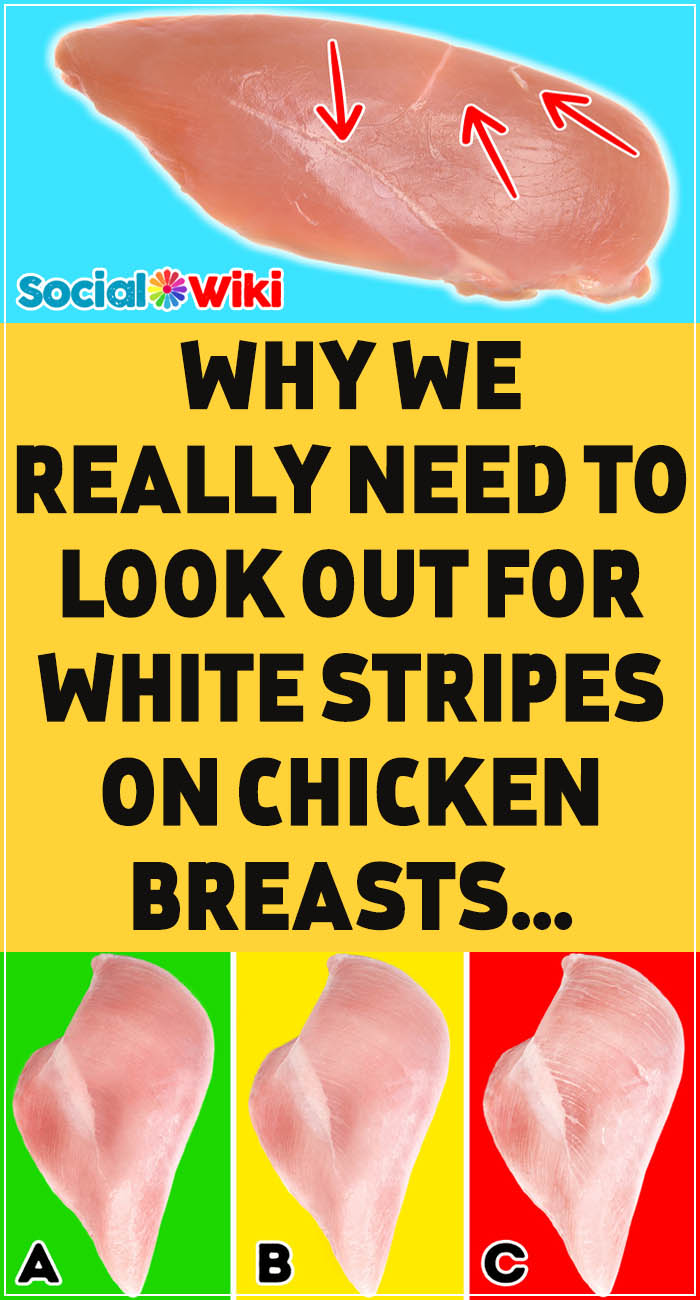 Why We Really Need to Look Out for White Stripes on Chicken Breasts 7